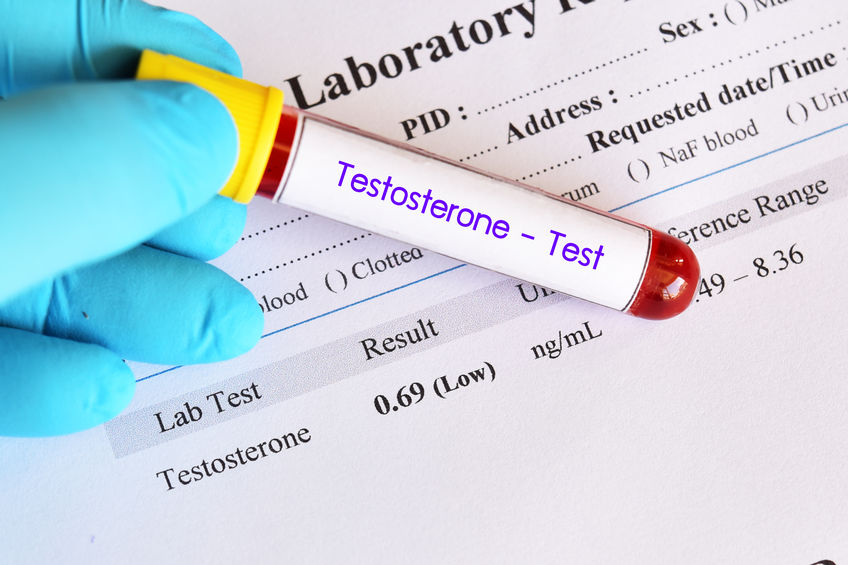 Hormone Testing